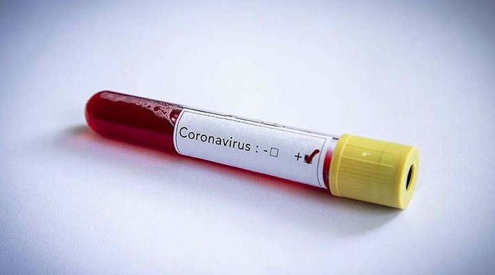 "Koronavirüs hastalarına verilen ilaçlar kalp hasarına neden oluyor" iddiası Meclis'te