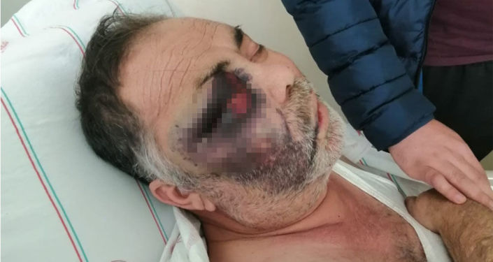 Antalya'da evinin önünde engelli adamın darp sonrası ölümünde ikinci tutuklama