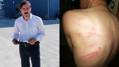 Hastanenin eksiklerini haber yapan gazeteciyi dövdüler