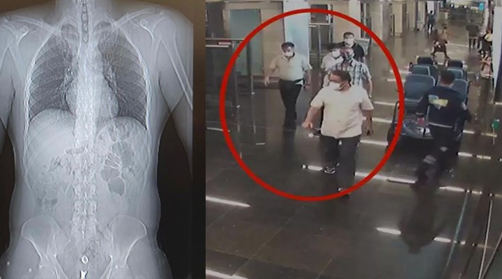 İstanbul Havalimanı'nda şüphe üzerine durdurulan turistlerin midesinden 3 kilo eroin çıktı