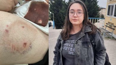Üniversite öğrencisi kampüste köpek saldırısına uğradı  