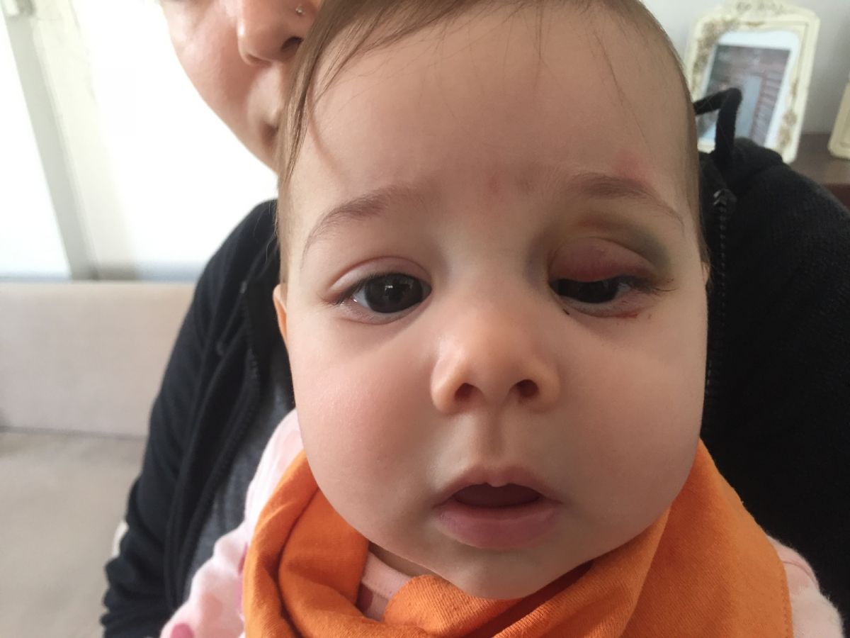 Adana da 7 aylık bebeğe yanlış ameliyat edildiği iddası #3