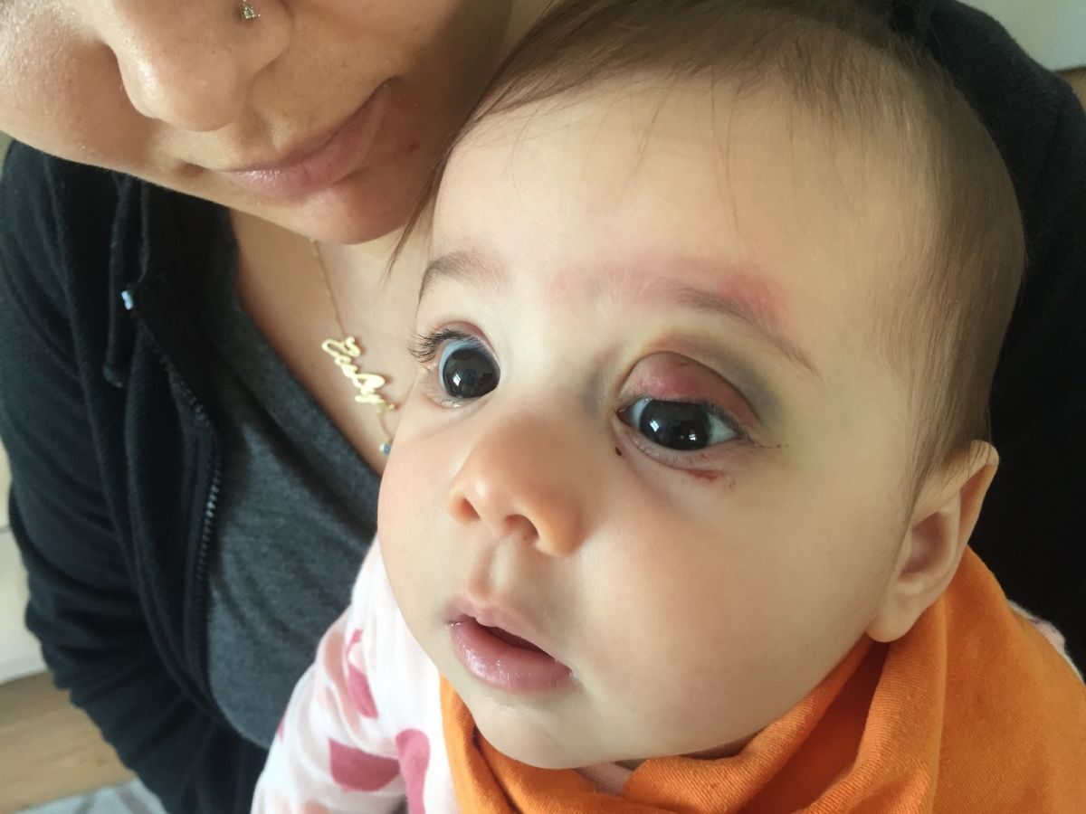Adana da 7 aylık bebeğe yanlış ameliyat edildiği iddası #4