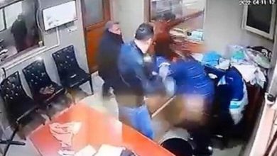 İşten çıkaran patronunun yüzüne asit attı