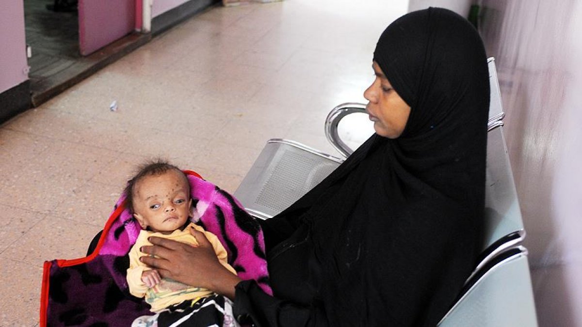 Yemenliler sıtma hastalığıyla boğuşuyor #4