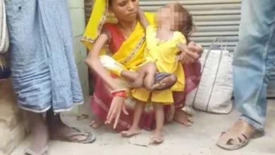 Görenler hayrete düştü! Hindistan'da bir bebek 6 bacaklı doğdu