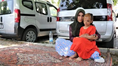 İzmir'de yüzü yanan 6 yaşındaki Dilara'ya, Sağlık Bakanlığı el uzattı